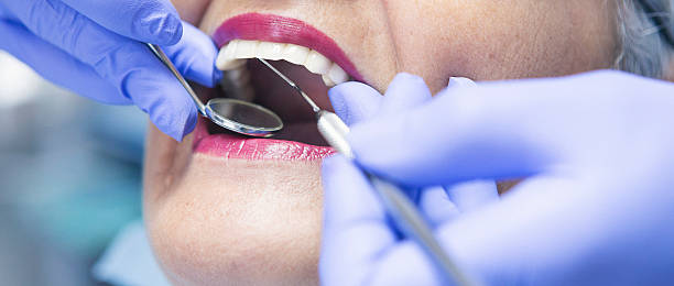 Best Emergency Dental Care for Broken or Chipped Teeth in Southern View, IL